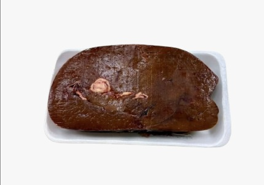 HIGADO